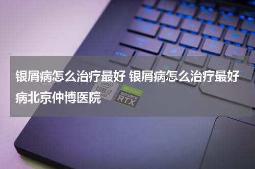 银屑病怎么治疗最好 银屑病怎么治疗最好病北京仲博医院